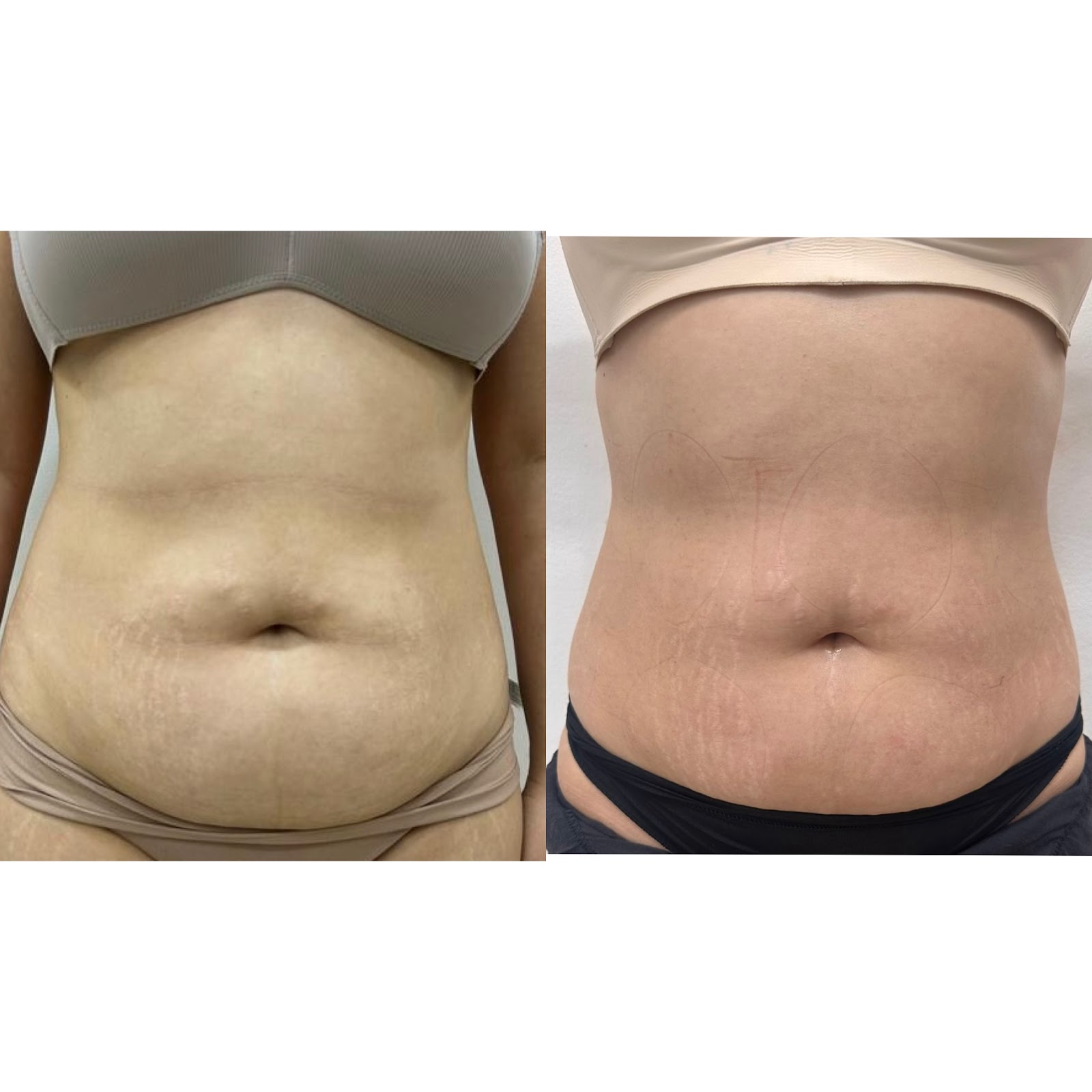 leetx-google-photo-80032-7 leetx-google-photo-80032-7